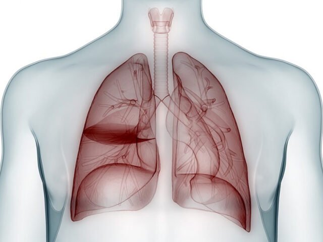 Complex Lung Disease
